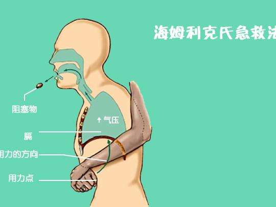 吞咽异物可致死 两种救护措施要牢记