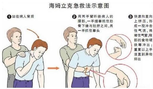 老人噎食该如何救护
